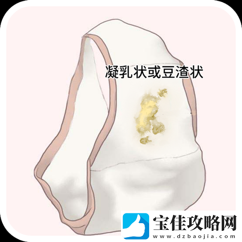 女生次数多了会有豆腐渣分泌物吗：相关问题深度剖析