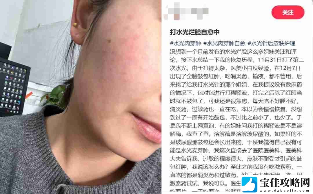 扎堆修复