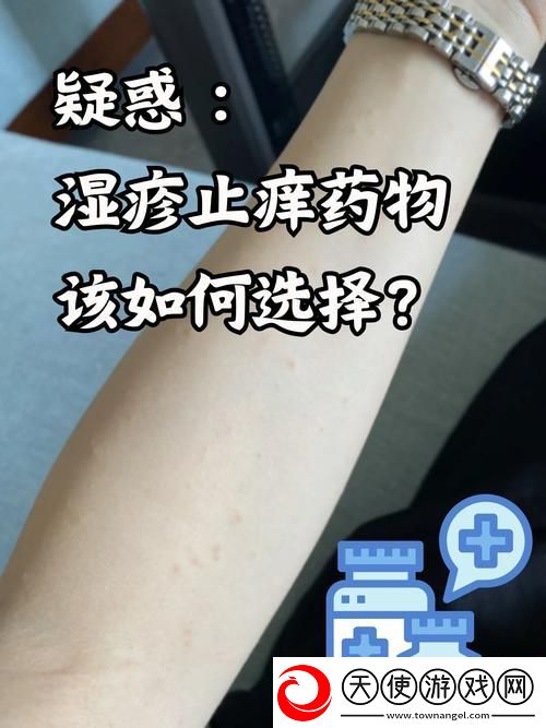 淑芬两腿间又痒痒的用药方法